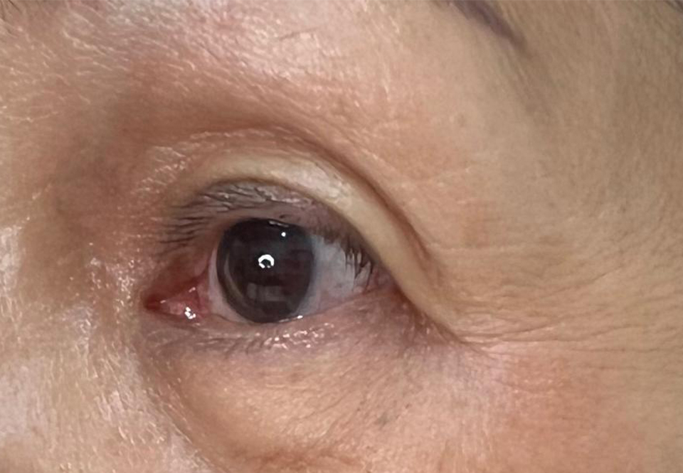 eyes 2