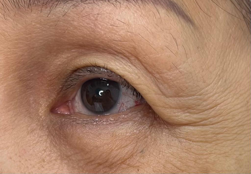 eyes