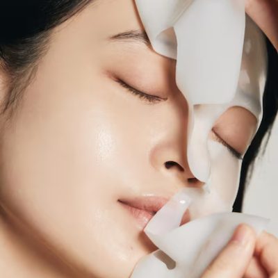 Meso needling Acne scar